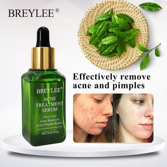 BREYLEE Acne Treatment Serum