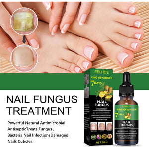 Nail Repair Solution Hand Foot And Nail Care Solution