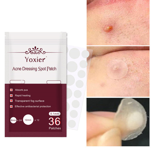 Acne Patch Anti-acne Principle