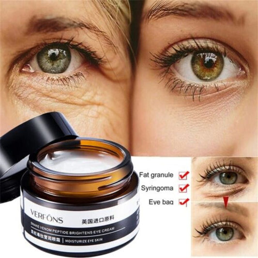 Moisturizing Eye Cream  Dark Circle Remover