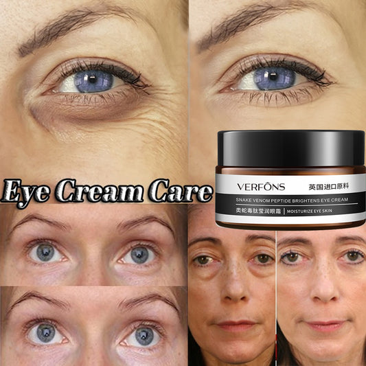 Moisturizing Eye Cream  Dark Circle Remover